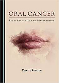 عکس Oral Cancer, 1st Edition2019 سرطان دهان